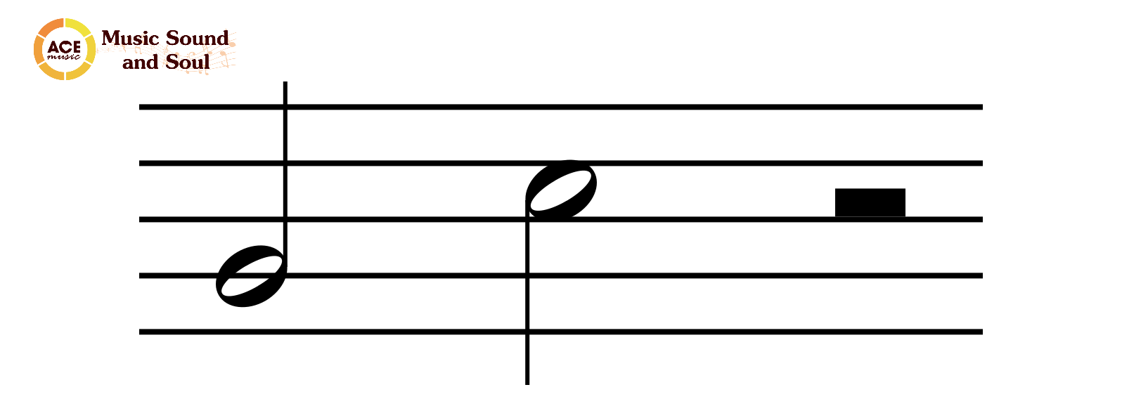 Trong âm nhạc, "nốt lặng trắng" (hay "rest trắng") là một ký hiệu biểu thị thời gian dừng lại hoàn toàn trong một đoạn nhạc